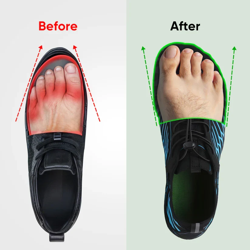 SKYE™ NON-SLIP BAREFOOT SHOES FOR NATURAL COMFORT (UNISEX) - Image 11